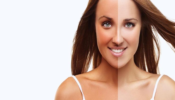 गर्मियों में टैनिंग की समस्या बढ़ाती है परेशानी, इन तरीकों से करें इसे दूर