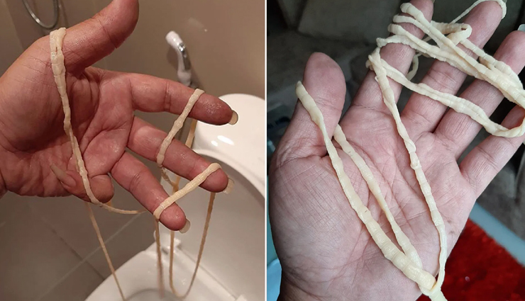 8 Home Remedies To Treat Tapeworms
