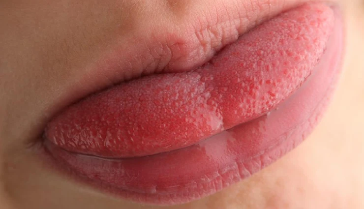 excess sugar symptoms,signs of too much sugar,refined sugar dangers,sugar health risks,hidden sugars in food,high sugar intake effects,sugar addiction signs,sugar and diabetes,refined sugar sources,how sugar affects body