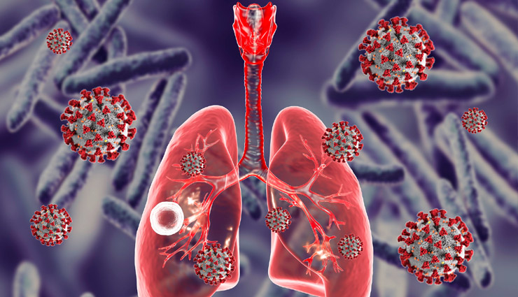 टीबी के बढ़ते मामलों की वजह कोरोना वायरस नहीं: स्वास्थ्य मंत्रालय