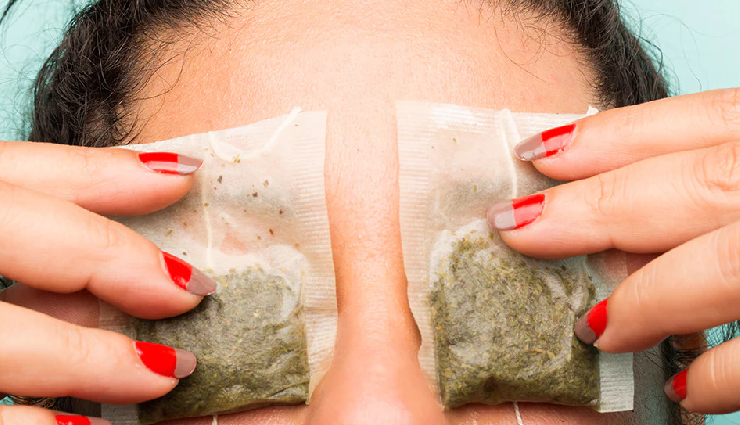 home remedies for eye redness,treat eye redness in summer,eye redness relief,natural remedies for eye irritation,summer eye care tips,soothing eye redness,conjunctival injection treatment,aloe vera for eye irritation,cold compress for red eyes,cucumber slices for eye relief,artificial tears for dry eyes,rose water for eye care,tea bags for inflamed eyes,hydration for eye health,uv protection for eyes,avoiding eye irritants,humidifier for dry eyes,blinking exercises for eye moisture