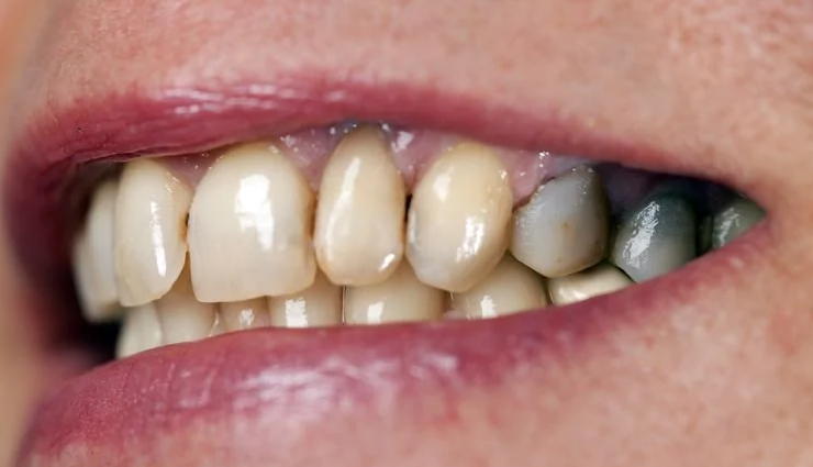 chai,health benefits of chai,health benefits of tea,Health tips,fitness tips