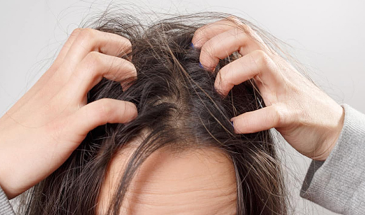 tea tree oil benefits,hair problems solution,tea tree oil for hair,hair care with tea tree oil,beauty tips with tea tree oil,tea tree oil beauty hacks,hair care benefits,tea tree oil hair remedies,natural hair solutions,tea tree oil for scalp,hair health with tea tree oil,beauty benefits of tea tree oil,tea tree oil hair treatment,scalp care with tea tree oil,tea tree oil hair growth,beauty hacks with tea tree oil,hair care secrets,tea tree oil for dandruff,hair care tips,tea tree oil hair mask