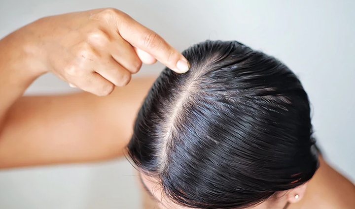 tea tree oil is the cure for many hair problems you get these amazing benefits,beauty tips,beauty hacks