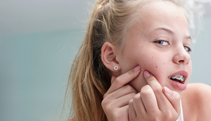 5 Things every teenager should know about their skincare routine