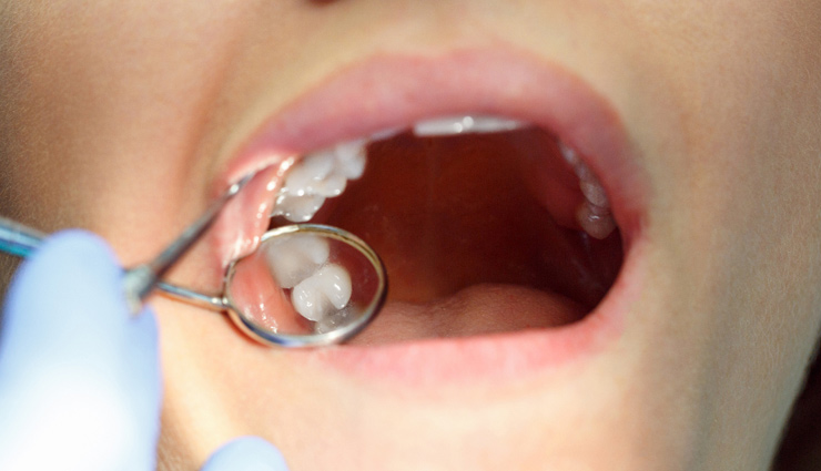 आपके दांतों पर भी बुरा असर डाल रहा कोरोना, न्यूयॉर्क से सामने आया ये चौकाने वाला मामला