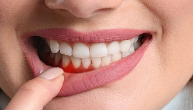 health benefits of radish,eating radish for health,nutritional benefits of radish,radish in a balanced diet,digestive health and radish,immune system boosting radish,radish for skin health,radish and detoxification,vitamins in radish,minerals in radish,antioxidants in radish,fiber in radish,radish and weight loss,low-calorie radish snacks,radish in a healthy diet plan,cooking with radish,raw radish recipes,pickled radish ideas,radish salads and sides,सेहत,स्वास्थ्य,हेल्थ,हेल्थ टिप्स,मूली,मूली के फायदे,मूली के लाभ,सफेद मूली के फायदे,मूली का महत्व,मूली के उपाय