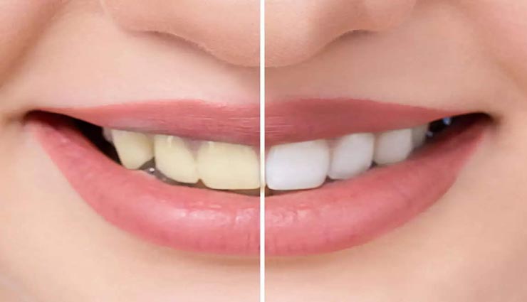 Health tips,health tips in hindi,home remedies,teeth remedies,teeth care tips