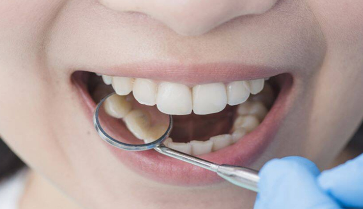 जानें किस तरह बर्फ का इस्तेमाल दिलाएगा शरीर की समस्याओं में राहत Health tips,health tips in hindi,ice for relief,relief in body problems