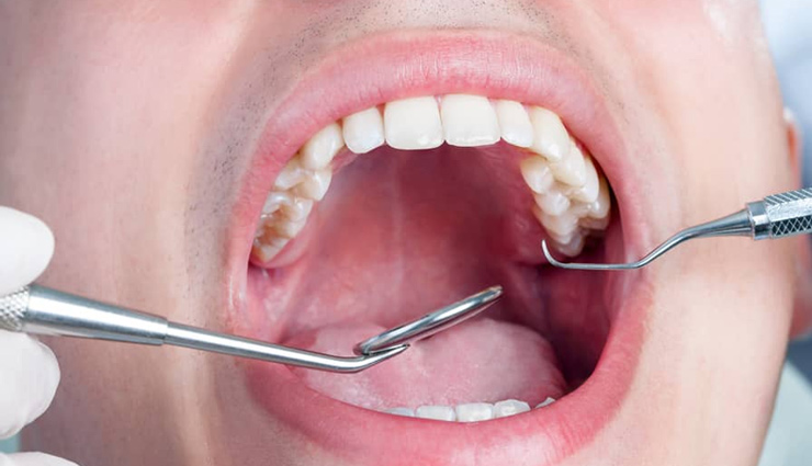 drawbacks of biting nails,biting nails problem,nails,Health,Health tips