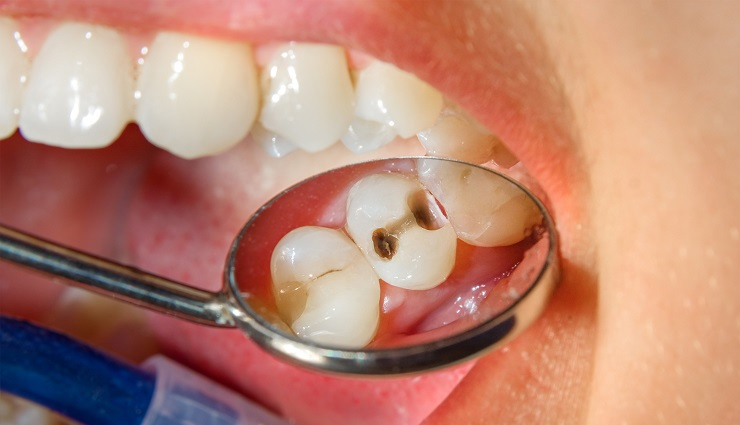 oil pulling benefits,health advantages of oil pulling,oil pulling for oral health,natural oral care with oil pulling,ayurvedic oil pulling benefits,coconut oil pulling benefits,improved dental health through oil pulling,detoxification benefits of oil pulling,oil pulling and gum health,daily oil pulling routine