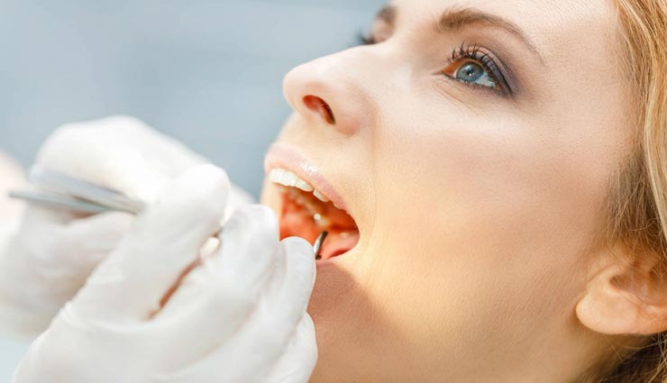 दांतों की हर समस्या का निवारण करेंगे ये घरेलू नुस्खें, देंगे मिनटों में राहत 