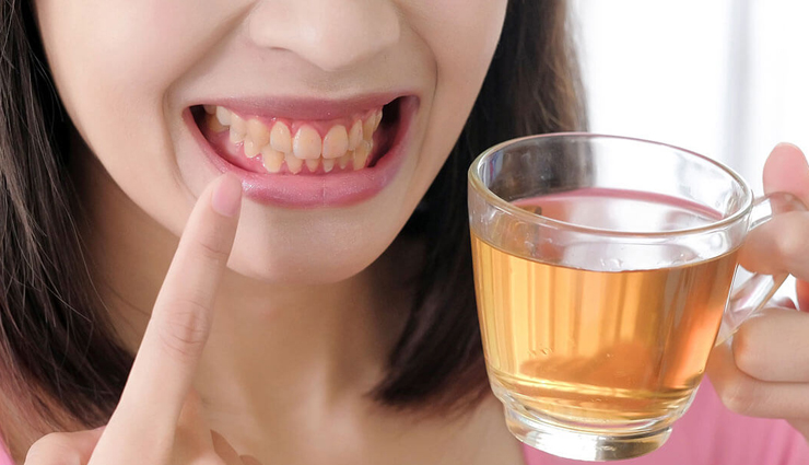 teeth stains,home remedies for teeth stains,teeth care tips,Health tips,fitness tips