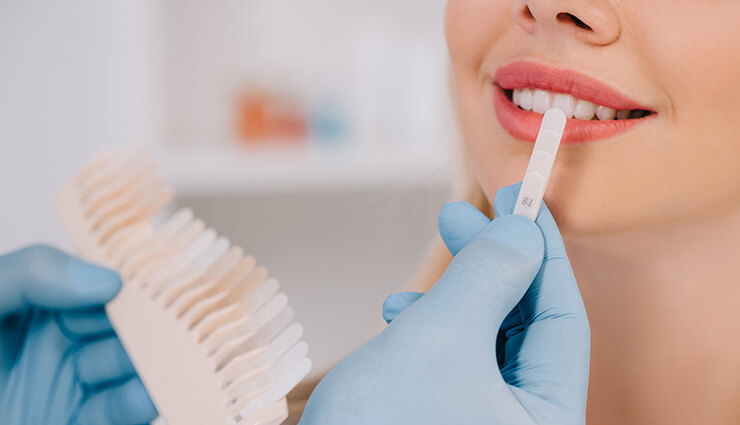 oral health care tips,dental care advice,tips for healthy teeth,oral hygiene tips,dental health recommendations,best practices for oral care,tips for strong teeth and gums,maintaining oral hygiene,dental health habits,oral care guidelines,brushing techniques for teeth,flossing tips for oral health,mouthwash benefits and usage,preventing gum diseases,oral care for fresh breath,diet and dental health,dental check-up importance,dental care for children,natural remedies for oral health,daily oral care routine,tips for cavity prevention,dental care for sensitive teeth