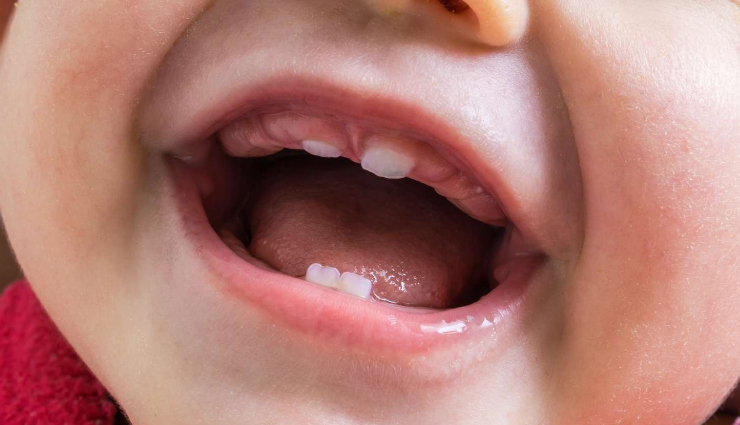 7 Signs of Teething in Babies