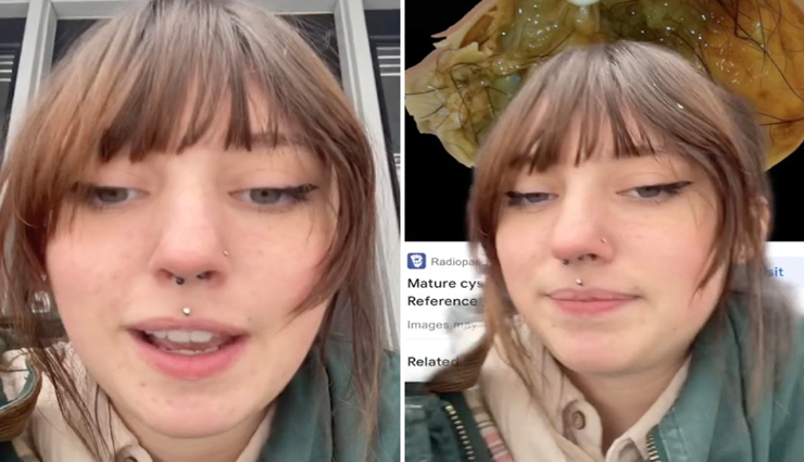 महिला मान रही थी गर्भ में पल रहा हैं बच्चा लेकिन सच्चाई निकली कुछ और ही, जानें पूरा मामला 