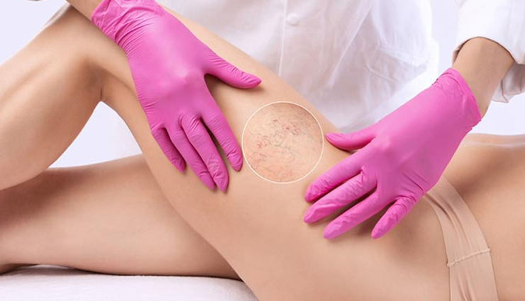 harmful effects of laser hair removal,risks of laser hair removal,dangers of laser hair removal,side effects of laser hair removal,is laser hair removal safe?,laser hair removal and skin damage,skin risks with laser hair removal,health concerns of laser hair removal,laser hair removal drawbacks,complications of laser hair removal,laser hair removal safety issues,skin damage from laser hair removal,negative impacts of laser hair removal,laser hair removal and skin sensitivity,allergic reactions to laser hair removal,skin irritation from laser hair removal,skin discoloration and laser hair removal,laser hair removal and scarring,burns from laser hair removal,laser hair removal and long-term effects,alternatives to laser hair removal
safe hair removal methods,best practices for hair removal,skin care after laser hair removal,consultation before laser hair removal