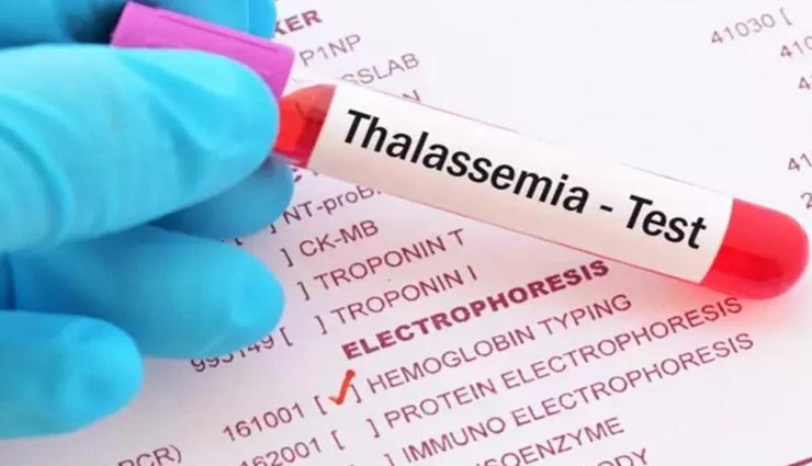 Health tips,health tips in hindi,world thalassemia day,symptoms and treatment