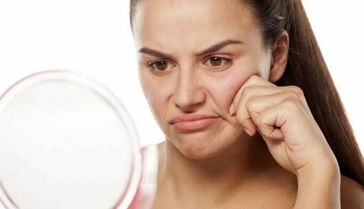 हो चुकी हैं पिचके गालों से परेशान, इन्हें गोल-मटोल बनाने के लिए आजमाए ये नुस्खें