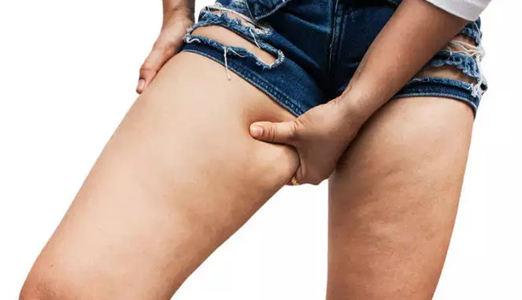 Practical Exercises To Reduce Thigh Fat