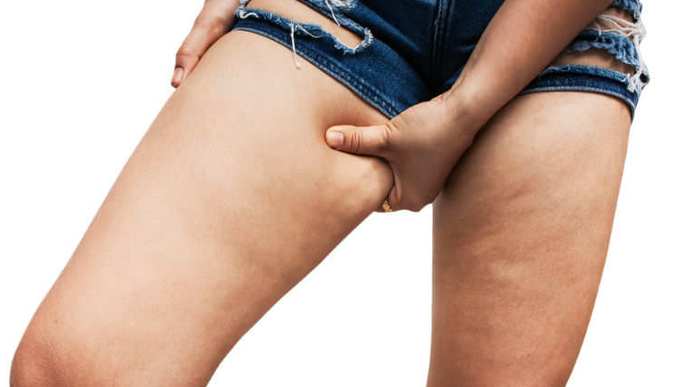 5 Exercises To Help You Reduce Thighs Fat