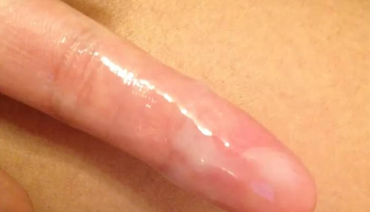 pregnancy discharge,white discharge during pregnancy,vaginal discharge in pregnancy,normal discharge during pregnancy,types of discharge during pregnancy,early pregnancy discharge,abnormal pregnancy discharge,white milky discharge during pregnancy,causes of white discharge during pregnancy,how to manage white discharge during pregnancy,when to see a doctor for pregnancy discharge,third trimester white discharge,preventing infection with pregnancy discharge,coping with pregnancy discharge,understanding pregnancy discharge