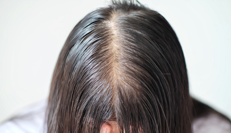 castor oil for hair,use of castor oil for hair,benefits of castor oil for hair,hair care tips,hair