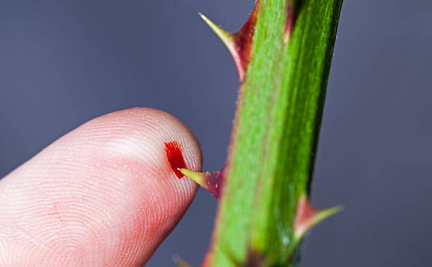 thorn pick,treat thorn pick,home remedies,home remedies for thorn pick,Health tips