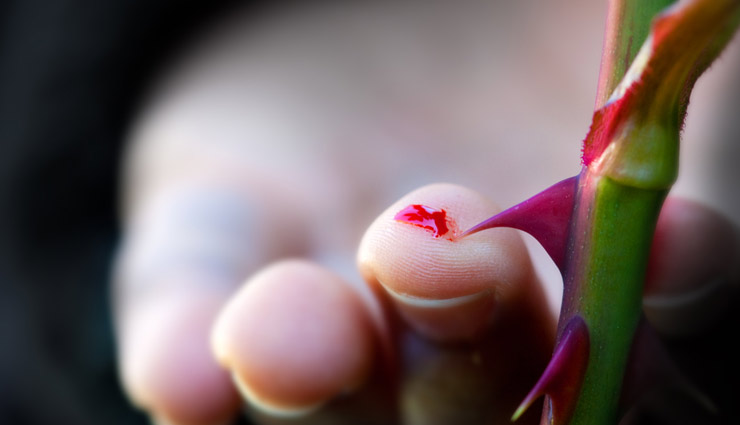 कांटा चुभने पर तुरंत करें ये उपाय, मिनटों में मिलेगा आराम