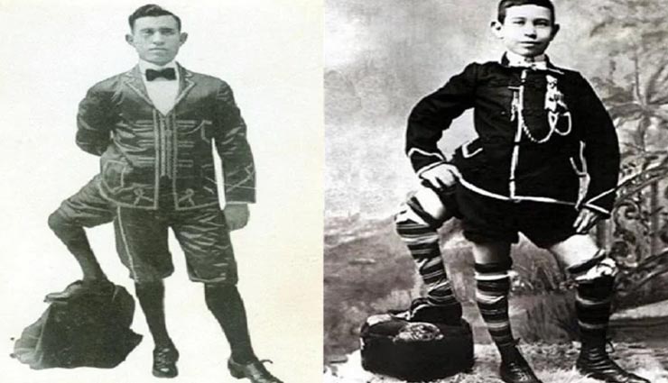 इस तीन टांगों वाले व्यक्ति ने पूरी दुनिया को किया 77 साल तक हैरान weird news,weird person,three legged man,frank lentini,interesting story