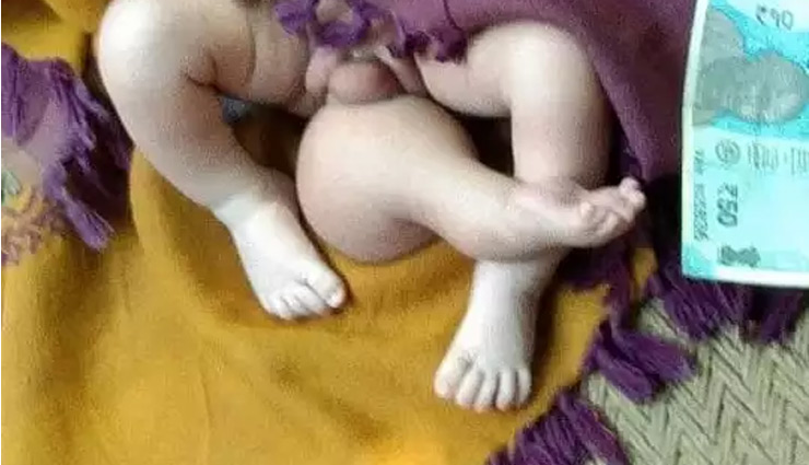 उत्तर प्रदेश / तीन पैरों वाले बच्चे ने लिया जन्म, लोग मान रहे दैवीय रूप, चढ़ाने लगे चढ़ावा