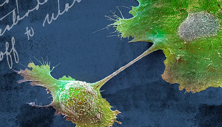 turmeric for thyroid,thyroid,Health tips,fitness tips