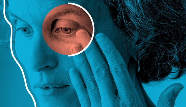 World Thyroid Day- 6 Foods That You Should Eat When Suffering From Thyroid Eye Disease