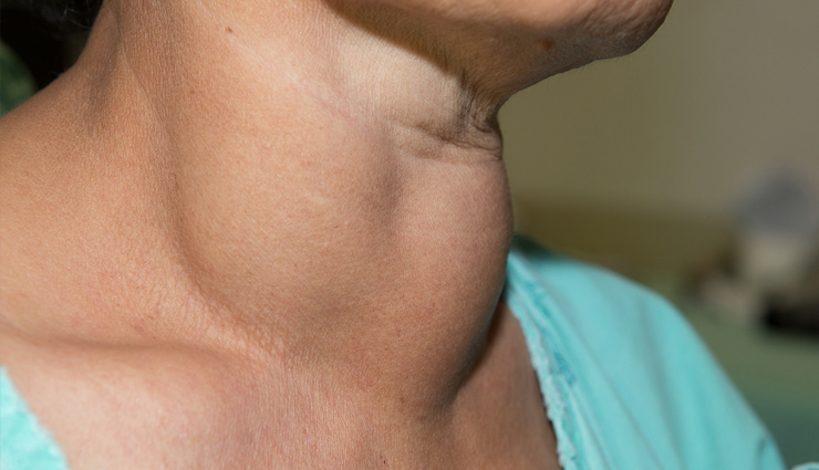 ways turmeric benefits thyroid health,turmeric benefits,healthy living,Health tips