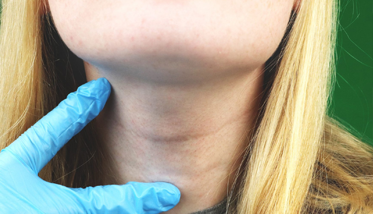 postpartum thyroiditis,key symptoms,treatment