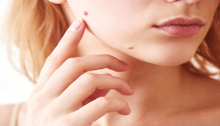 चेहरे के तिल घटाते हैं आपकी खूबसूरती, मेकअप की मदद से छिपाए इन्हें