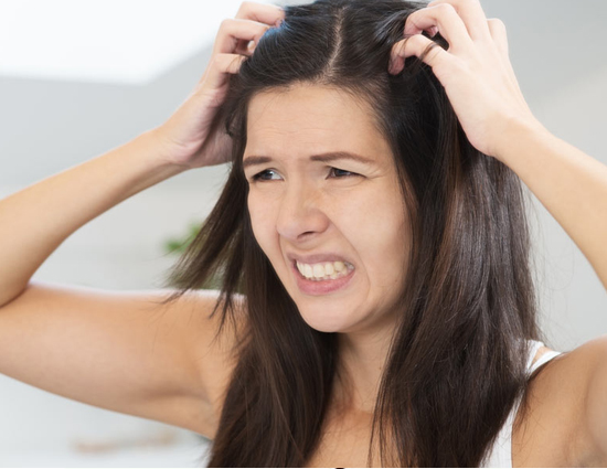Embarrassed of Scratching Your Scalp, Try These Ingredients to Treat Itchy Scalp