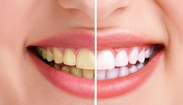 tobacco,clean tobacco stains from teeth,home remedies to clean teeth