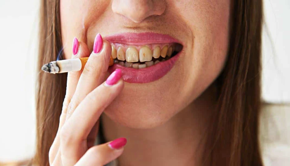 तंबाकू की वजह से दांतों पर जम गई गंदगी से है परेशान? बस एक चुटकी हल्दी से पाएं फिर से चमकती मुस्कान; जानें कैसे