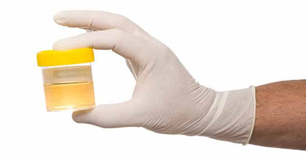 urine infection,urine,blood in urine,Health tips,healthy living