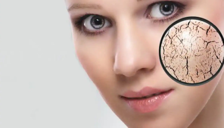 diy tomato face packs,natural glow tomato face packs,homemade tomato face packs,tomato face masks for glowing skin,tomato-based face packs,tomato skin care recipes,tomato face packs for radiant skin,tomato face packs for acne-prone skin,tomato face packs for oily skin,tomato face packs for dry skin,beauty tips