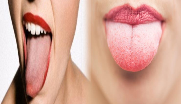 Health tips,health tips in hindi,color of tongue,disease by tongue