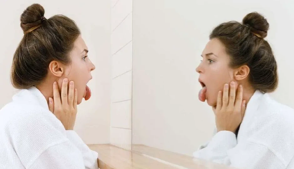 जीभ से जानिए सेहत का हाल, रंग बदलना हो सकता है कई बीमारियों का संकेत