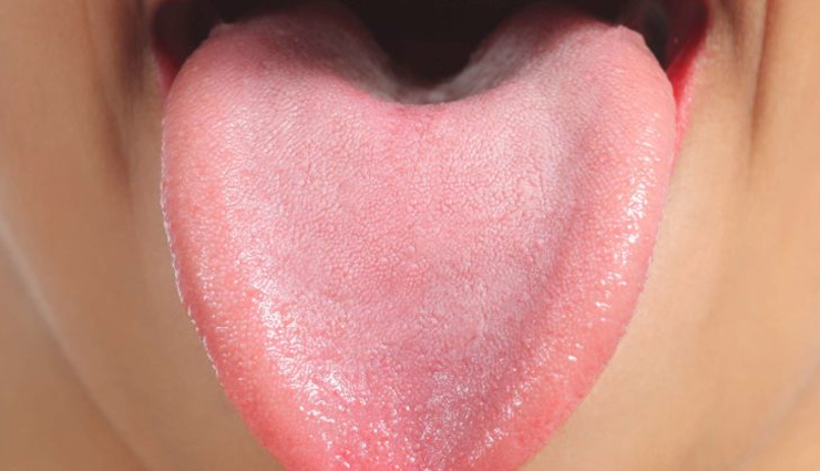 types of diseases that are reflected with tongue color,tongue color,Health tips,fitness tips
