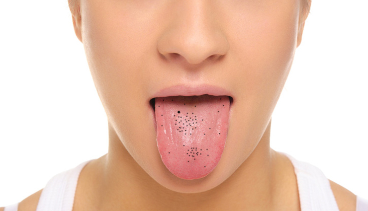 diseases associated with tongue color,different tongue color,Health tips,fitness tips