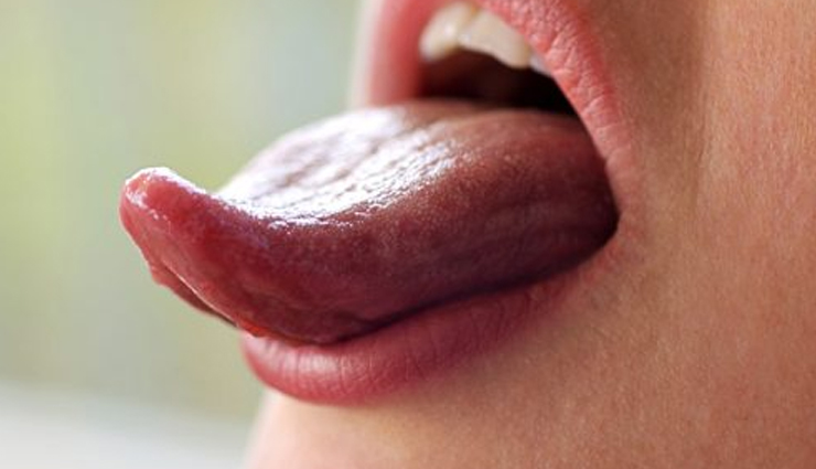 diseases associated with tongue color,different tongue color,Health tips,fitness tips