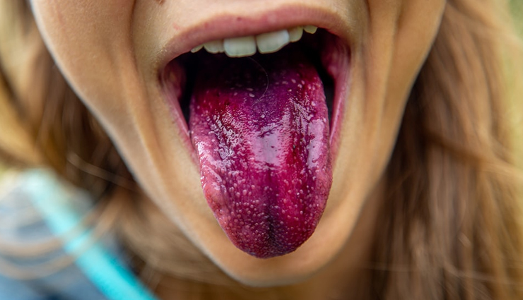 health from color of tongue,Health tips,fitness tips