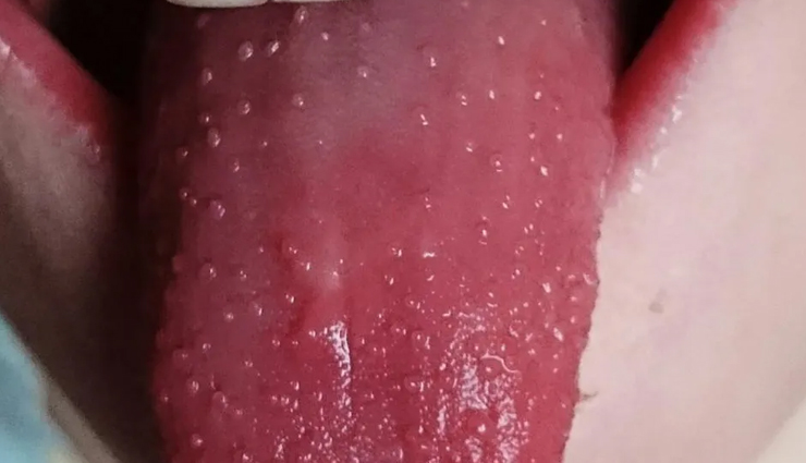 types of diseases that are reflected with tongue color,tongue color,Health tips,fitness tips