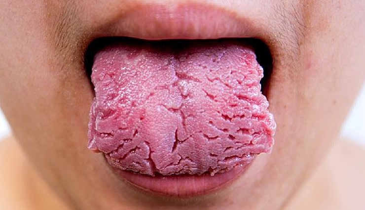 types of diseases that are reflected with tongue color,tongue color,Health tips,fitness tips