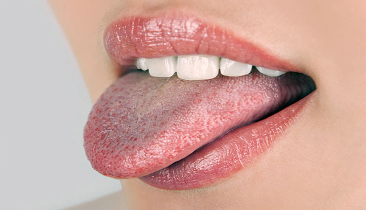 color of your tongue tells about your health,healthy living,Health tips